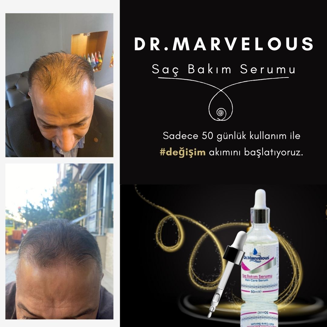 Doğal Saç Serumu 50ml + 50ml